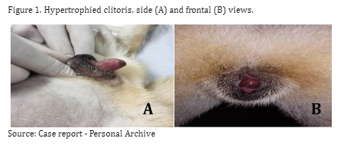 Figure 1. Hypertrophied clitoris, side (A) and frontal (B) views.