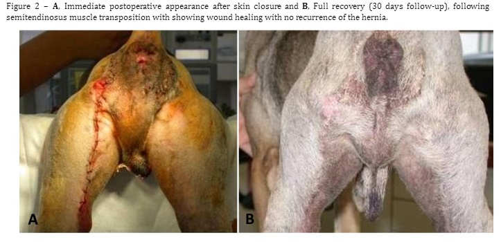 Figure 2 – A, Immediate postoperative appearance after skin closure and B, Full recovery (30 days follow-up), following semitendinosus muscle transposition with showing wound healing with no recurrence of the hernia. 